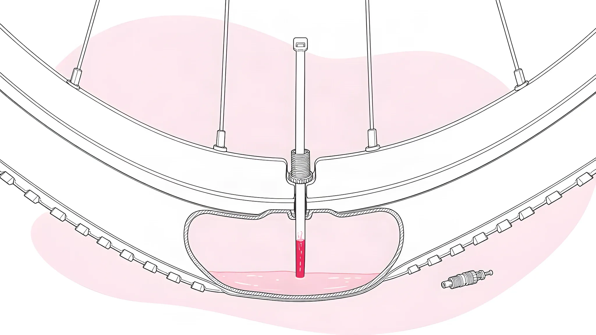Cut-away drawing of the bottom of a tubeless wheel with the valve at six o'clock, the core removed and a cable tie pushed through the valve into a shallow pool of sealant